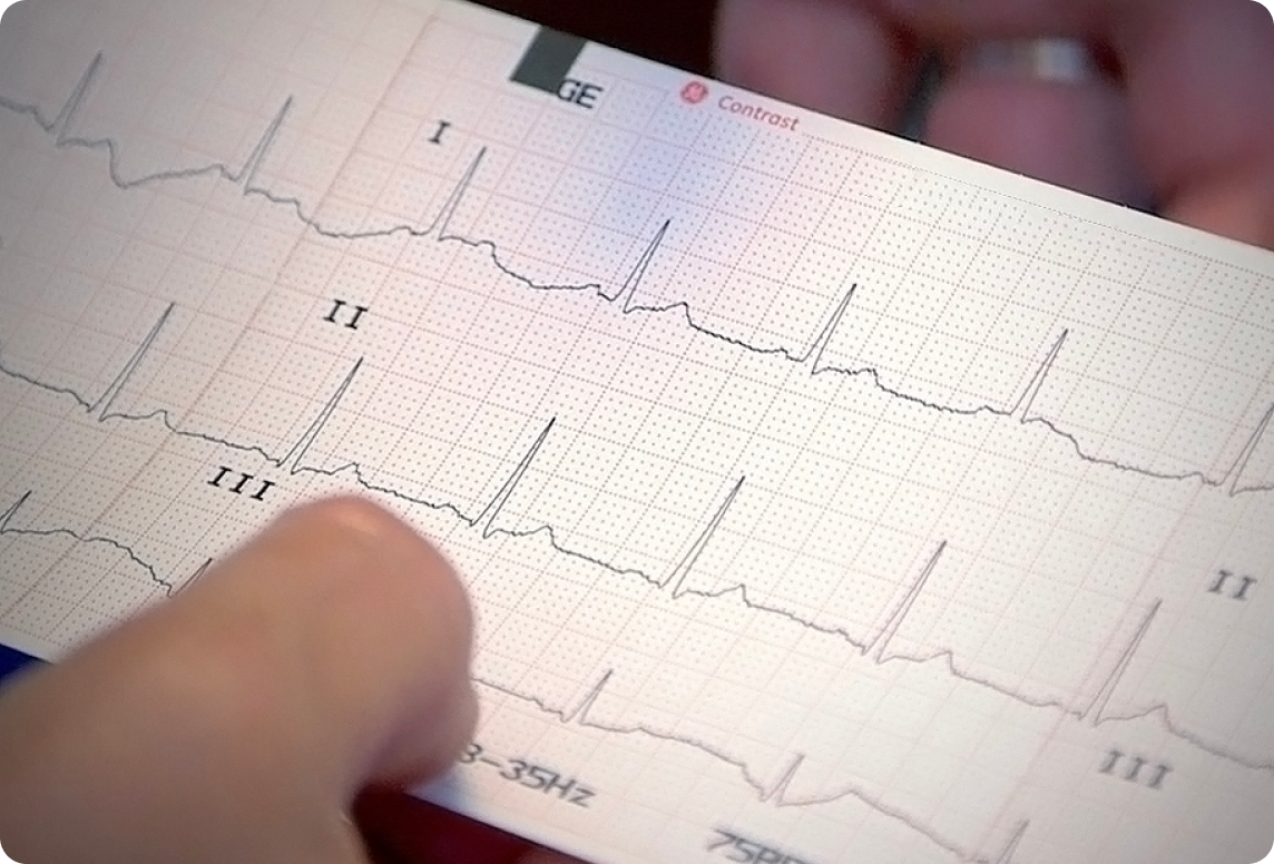 Read ECGs Better Than a Cardiologist