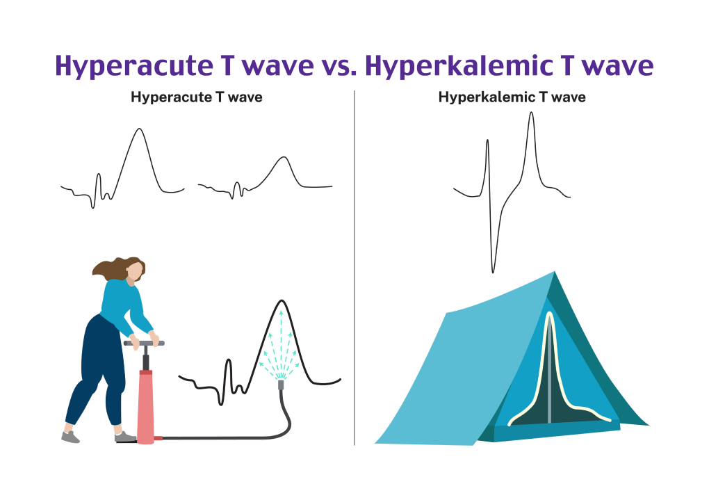 Distinguish Wave Differences