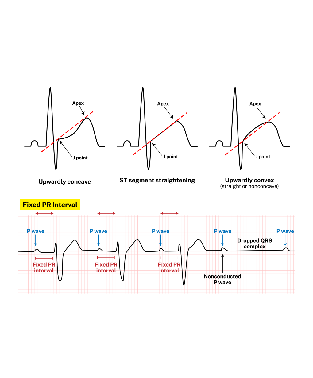 Understand Intervals, Morphology, and Blocks