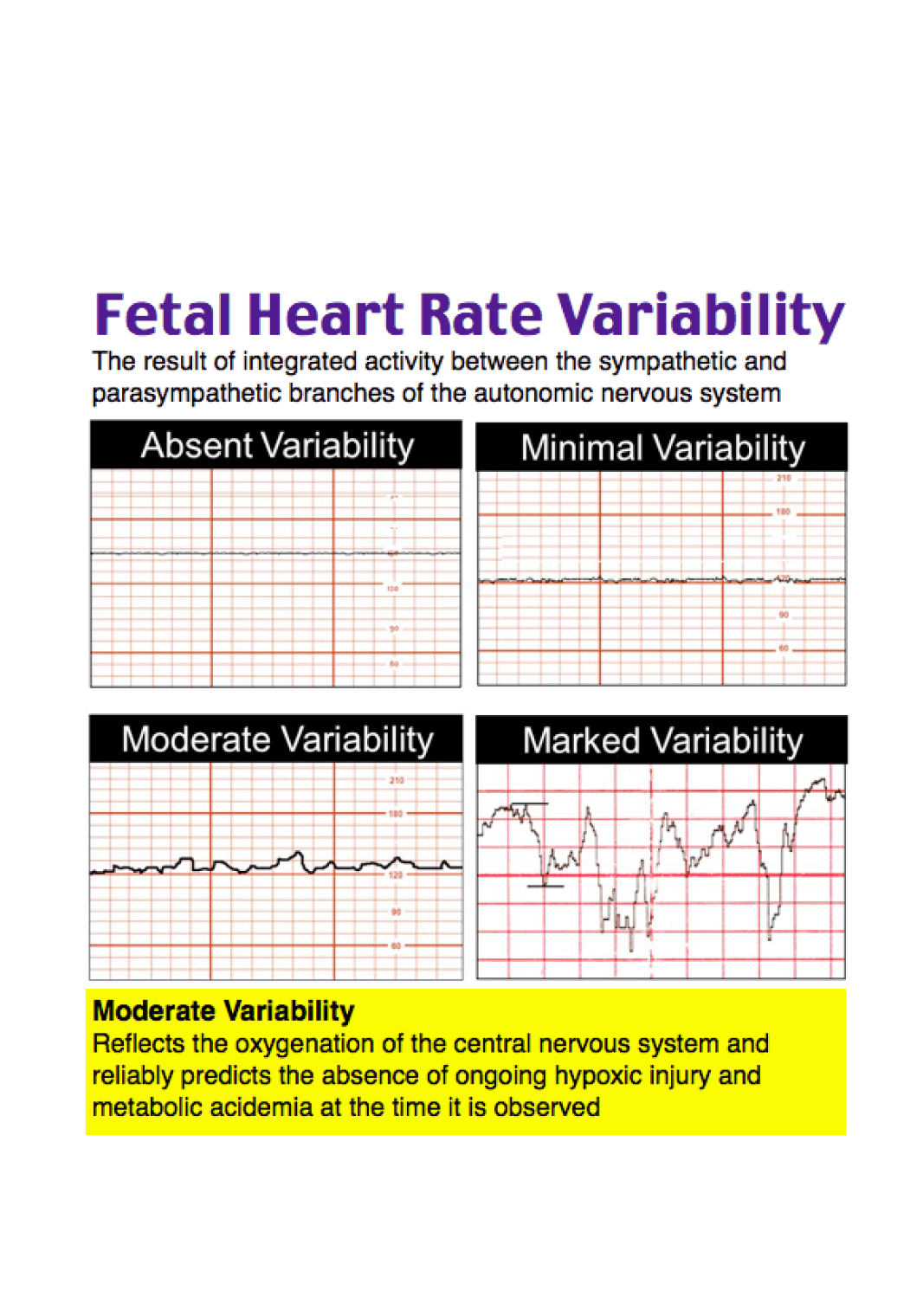  Fetal heart rate variability